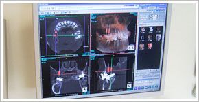 歯科用CT装置