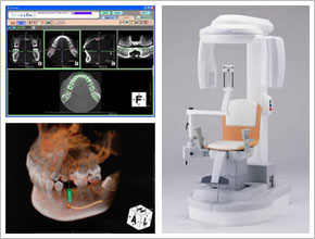 歯科用CT装置「ファインキューブ」